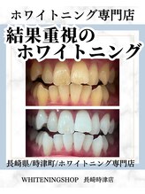 ホワイトニングショップ 長崎時津店/回数を重ねることで白い歯へ★