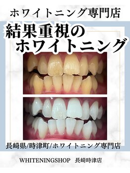 ホワイトニングショップ 長崎時津店/回数を重ねることで白い歯へ★