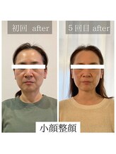 マシェリ(ma cherie)/全メニューに小顔整顔ケア付き