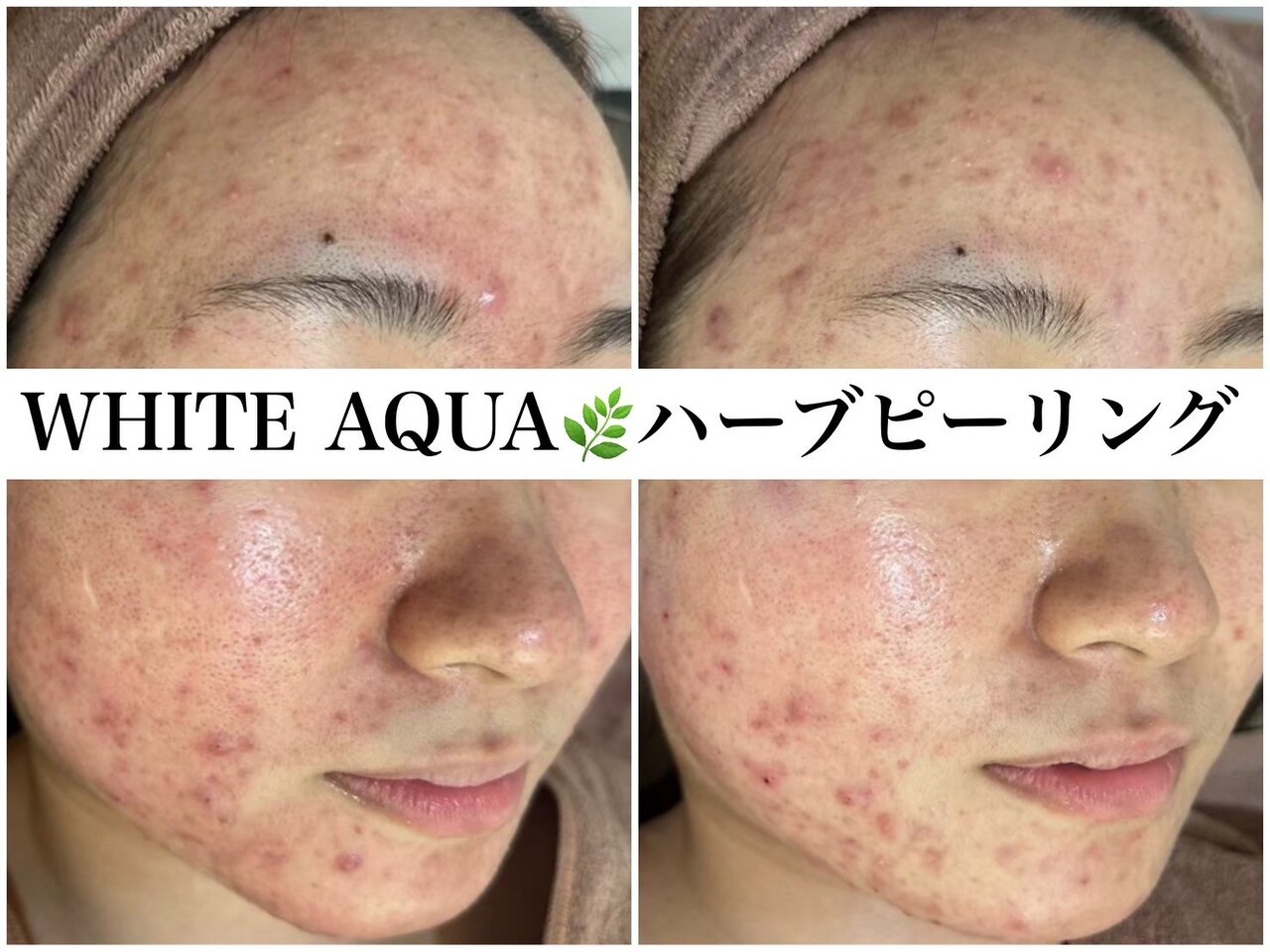 フォト｜ホワイトアクア 広島店(WHITE AQUA)｜ホットペッパービューティー