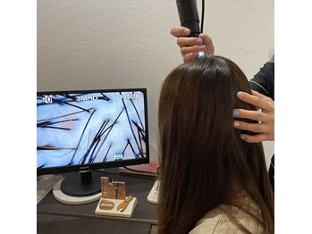 フォルテ(Forte)の写真/丁寧なカウンセリングと頭皮環境チェック!プロの施術者が、あなたのお悩みに寄り添い改善へと導きます♪