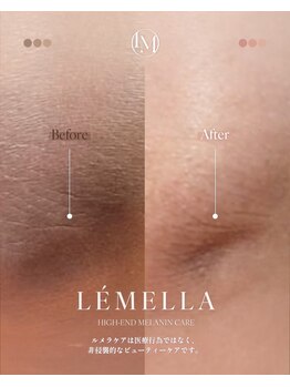 ピュアソル 福岡店(Puresol)/ルメラ