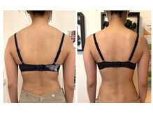 美人バスト 辻堂店/バストアップ　★☆症例写真☆★