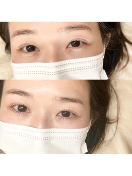 リリフリー(riri Free)/下まつ毛LED　有と無　アプダン