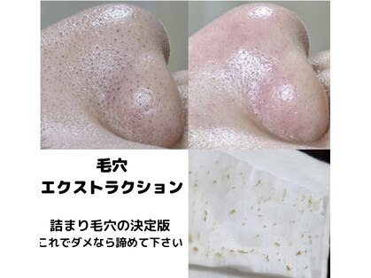 ボニータ(Bonita)の写真