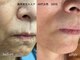 アンドイー(and E)の写真/歴40年のプロがこだわり抜いた本格フェイシャルサロン。最高峰マシンで長年の毛穴や凹凸肌、シミしわ改善へ