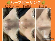 ボディエイジングラボ マハロ(MAHALO)/毛穴レス女優肌