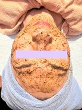 トオチカヘルスケア/ハーブピーリング