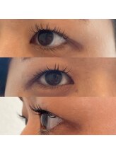 ミニョンプラス(Mignon+)/次世代パリエクで物足りなさ解消