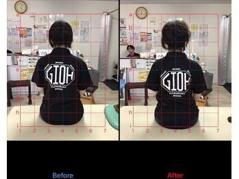 ストレチックス 近江八幡店/BeforeAfter