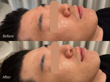 アウラ 小杉店(AULA)/