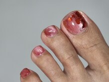 フットネイルは年中通して大人気[センター南/センター北/新横浜]