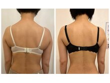 美人バスト 辻堂店/バストアップ　★☆症例写真☆★