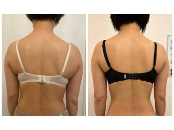 美人バスト 辻堂店/バストアップ ★☆症例写真☆★