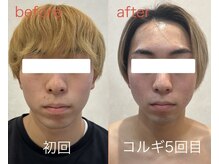 ビーキュート 姫路店(BE-CUTE)/コルギ5回目