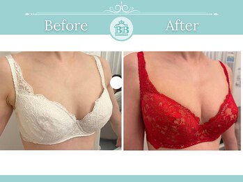 美人バスト 渋谷店/【バストアップ・育乳】◇症例◇