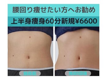 ナナ 銀座(Nana)/内臓脂肪までアプローチできる