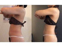 アミティエ(AMITIE)/ブライダルコース