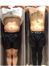 アイスタイル(i-style)/脂肪冷却/痩身ダイエット/泉大津