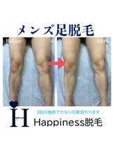 ハピネス 心斎橋アメリカ村本店(Happiness)/足脱毛
