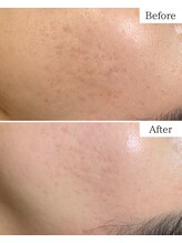 シャムリー(SHAMRY)/TROIAREUKE／スキンメイド