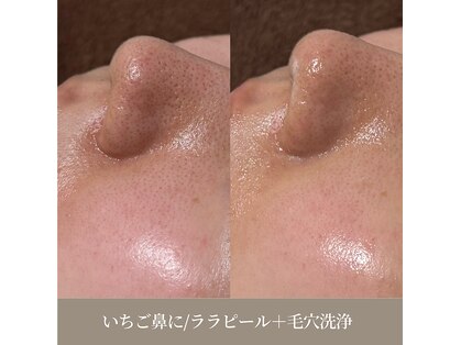 天使の艶肌 武蔵小杉店の写真