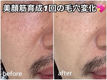 リエル(RIEL)/小顔矯正×美顔筋育成エステ