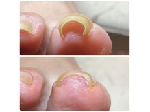 サロン ド ワカ(Salon de WAKA)の雰囲気（巻き爪インストラクター講師在籍の実力店！カウンセリング受付中）