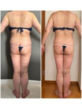 エミニー バイ エルズ(Eminy by L★s)/40代　セルゼロ全身　28回