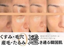 ヴィーナス(Venus)