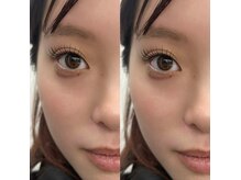 シーン(SCENE)/アンドヘルシー