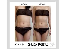 サロンフロム つくば店(Salon From)/◆セルゼロ上半身◆