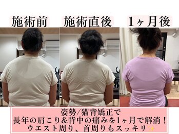 中京こじま整骨院/姿勢作り
