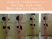 エターナルフレーム(Eternal Flame)/29歳下半身集中痩身スリム