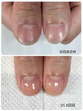 シーエスネイル 元住吉店(CS NAIL)/地爪育成コース