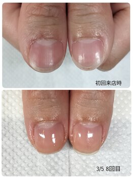 シーエスネイル 元住吉店(CS NAIL)/地爪育成コース