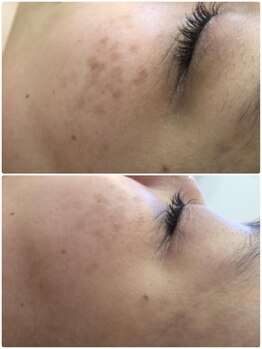 プリマプリート 島店/スノーピール