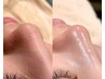 ピーリング効果＋顔脱毛！潤艶ワックス