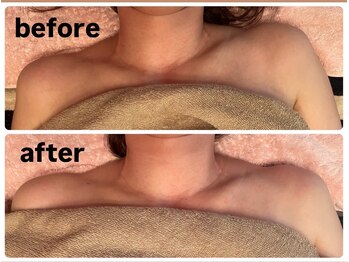 キプラ 福津店(KIPURA)/肩首こりが気になる方にも大絶賛