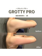 フルアナ(Hu ruana)/痩身/ダイエット/筋膜リリース