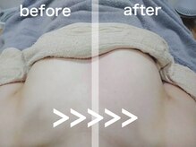 ソワンクールの雰囲気（直後から実感１００%→自宅ケアにて維持→施術で更にUPの連続）