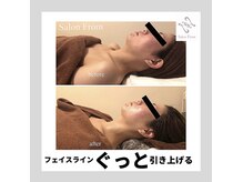 サロンフロム つくば店(Salon From)/◆インディバフェイシャル◆