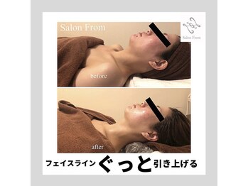 サロンフロム つくば店(Salon From)/◆インディバフェイシャル◆