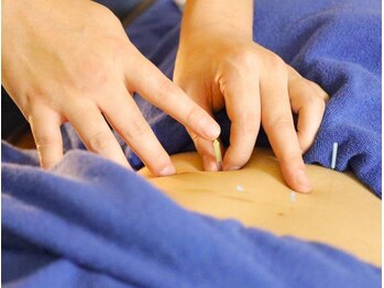 本厚木 リターナル(ReTurnal)/鍼/腰痛