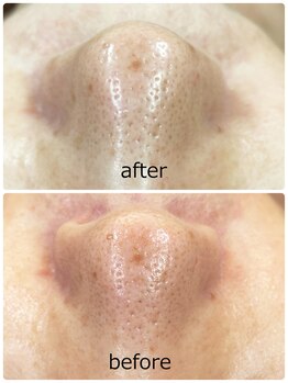 ハクミー(haku me)/☆次世代リバイブハーブ☆