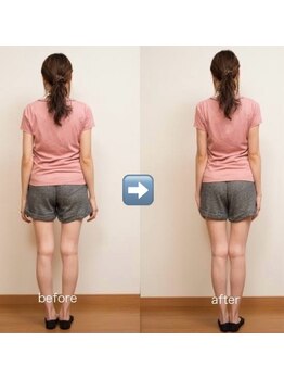 カイロプラクティック ネクサス/O脚と腰痛撃退☆