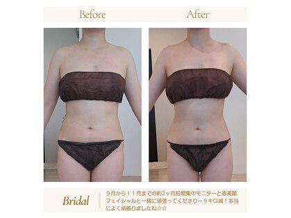 アンテ(Aunte.)の写真