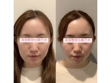美容整骨小顔ラボの雰囲気（《5回で激変！顔幅スッキリ！速攻小顔》小顔矯正×マシン）