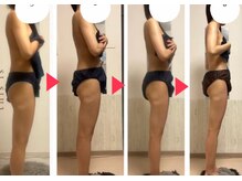 オーシャンブルーム 目黒(OceanBloom)/ブライダルエステハイパーナイフ