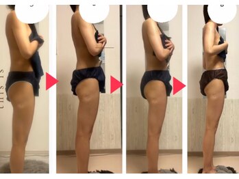 オーシャンブルーム 目黒(OceanBloom)/ブライダルエステハイパーナイフ